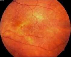 Bild 1: trockene AMD